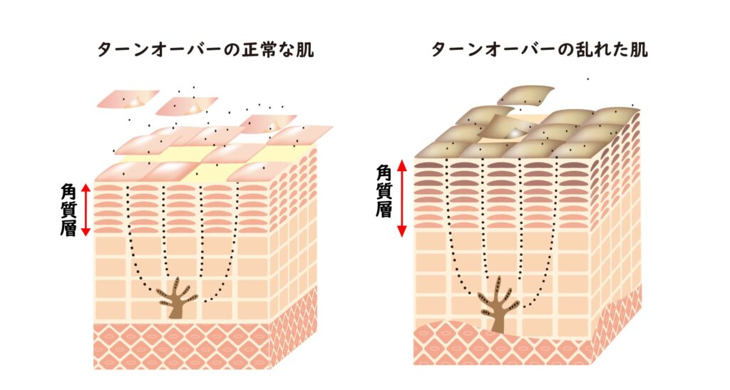 ターンオーバー肌画像