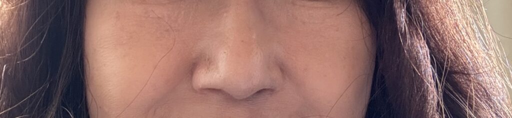 ゴルゴラインがきえた女性美容