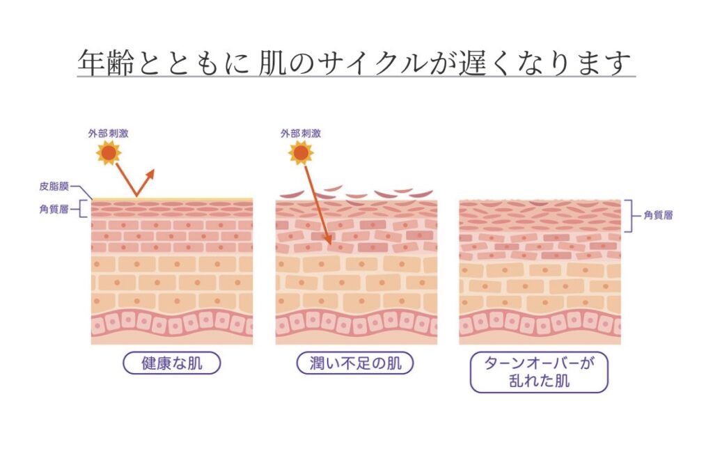 ターンオーバーの乱れ肌画像