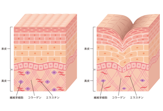 しわ肌画像