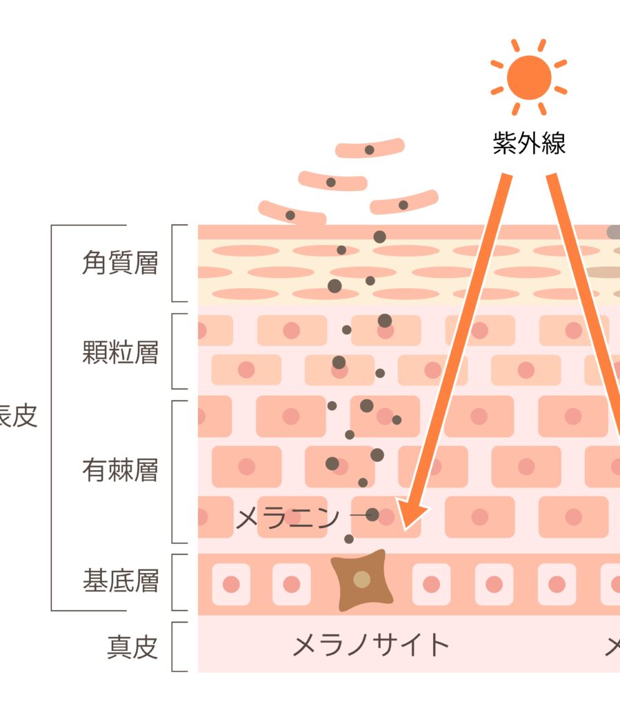 メラニン肌断面図、シミができる