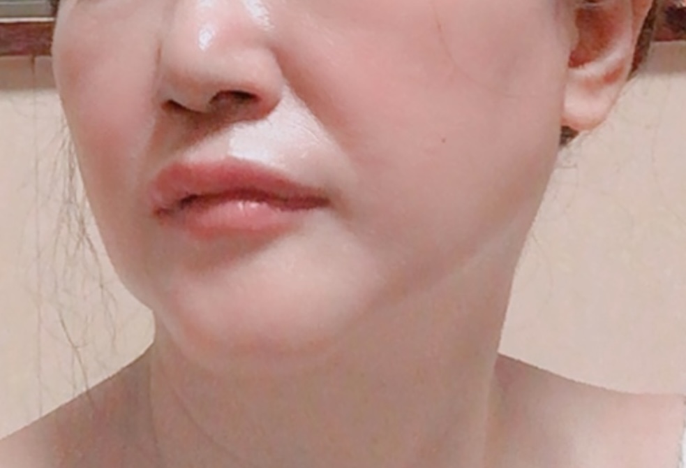 みずみずしい肌女