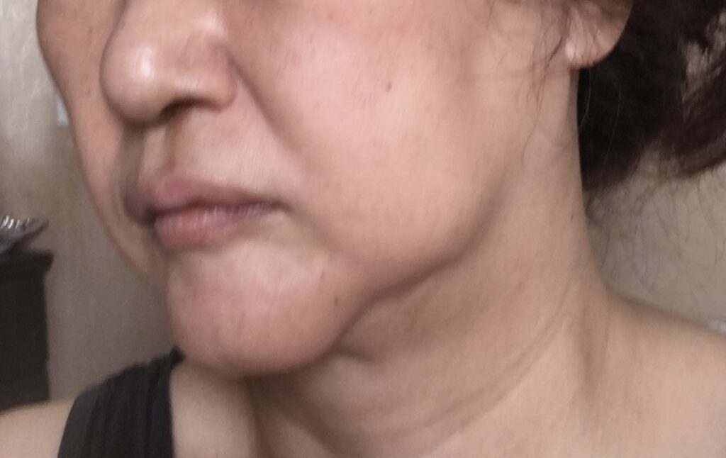 だるだるなフェスライン