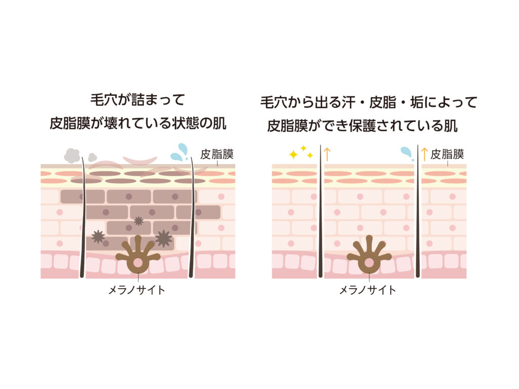 毛穴が詰まる肌画像