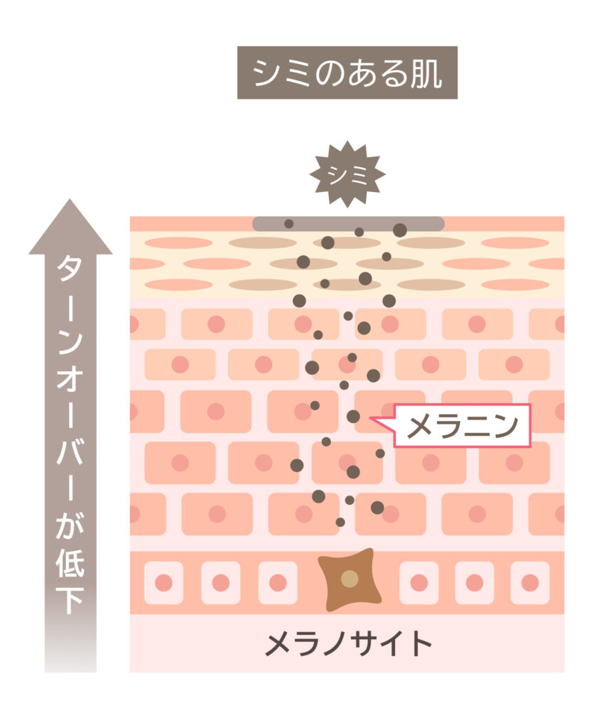 シミ肌画像