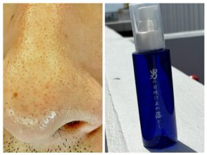 毛穴クレンジングケフィ横浜